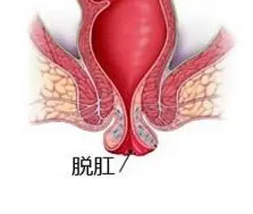 脱肛丸12