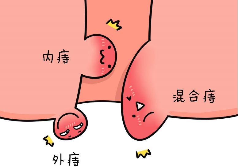 消痔丸29