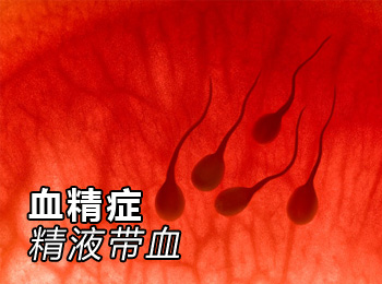 重阳丸(男子精中带血)47