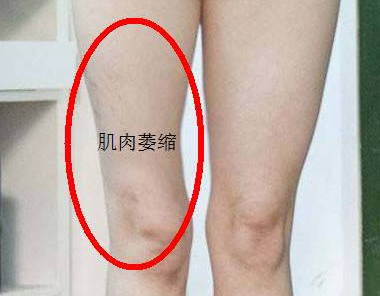 健筋骨丸(关节肌肉萎缩)，类似于仙丰制作的健力行89号